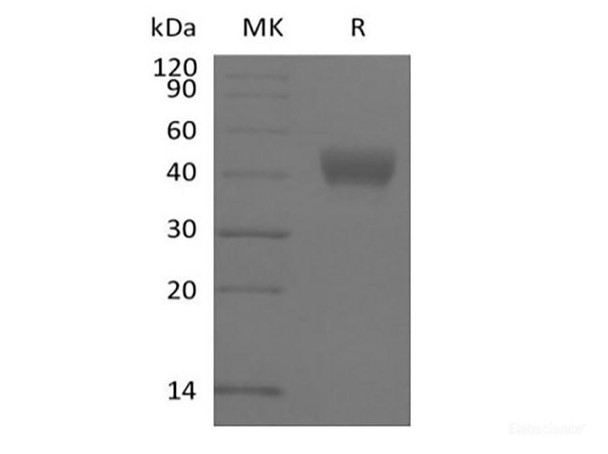 Recombinant Human ADP-ribosyl Cyclase/cyclic ADP-ribose Hydrolase 1/CD38 (N-6His-Avi) Biotinylated (RPES6231)