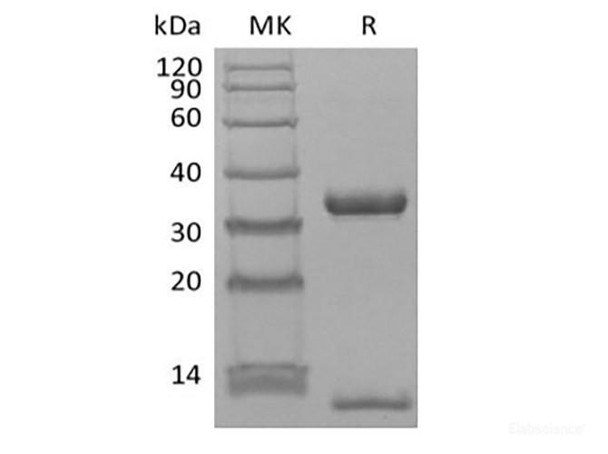 Recombinant Human FcRn & B2M Heterodimer (C-6His-Avi) Biotinylated (RPES6257)