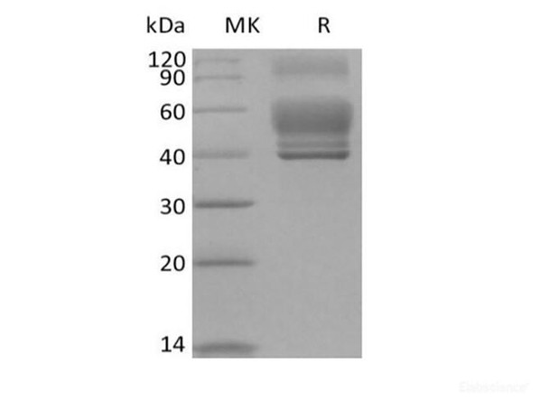 Recombinant Human Interleukin-13/IL-13 (C-Fc) (RPES6265)