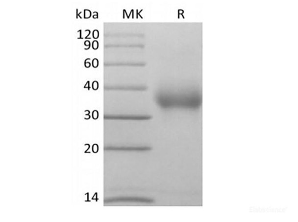 Human CD47/IAP/OA3  (C-Avi-6His) Biotinylated (RPES6312)