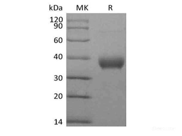 Recombinant Human Butyrophilin Subfamily 1 Member A1/BTN1A1 (C-6His-Avi) Biotinylated (RPES6332)