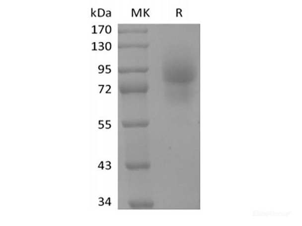 Recombinant Human CD68/SR-D1 (C-Fc) (RPES6376)