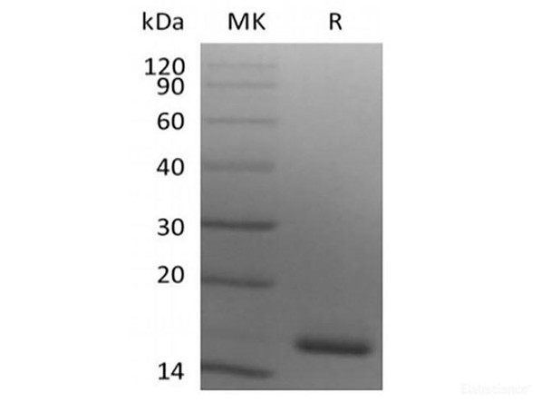 Recombinant Human Ig lambda constant 2 (C-6His) (RPES6400)