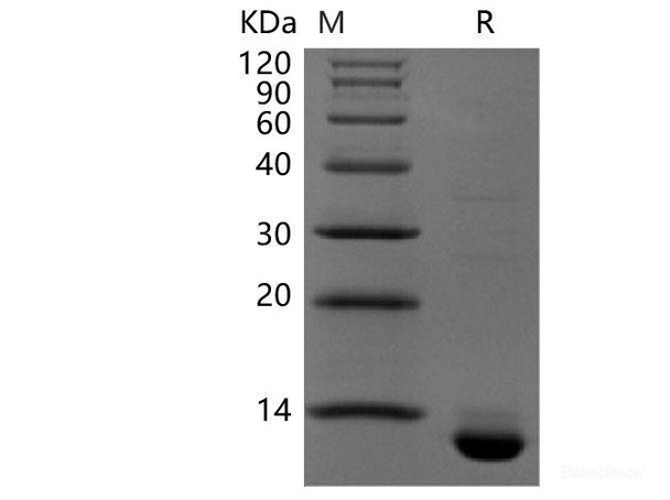 Recombinant Human CLDN18.2(N-6His,C-Avi) (RPES6407)