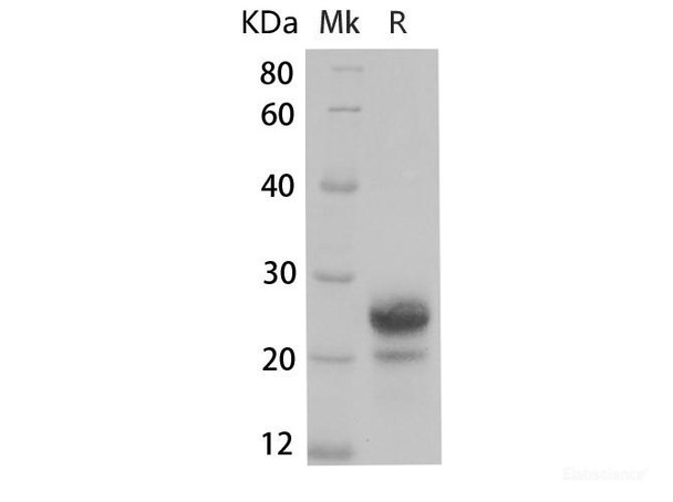 Human IL-7 Recombinant Protein (RPES6539)