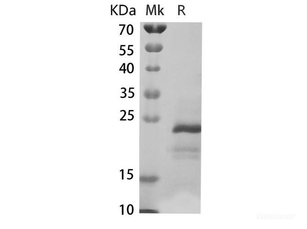Human CCL5/RANTES Recombinant Protein (RPES6561)