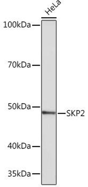Anti-SKP2 Antibody (CAB4046)