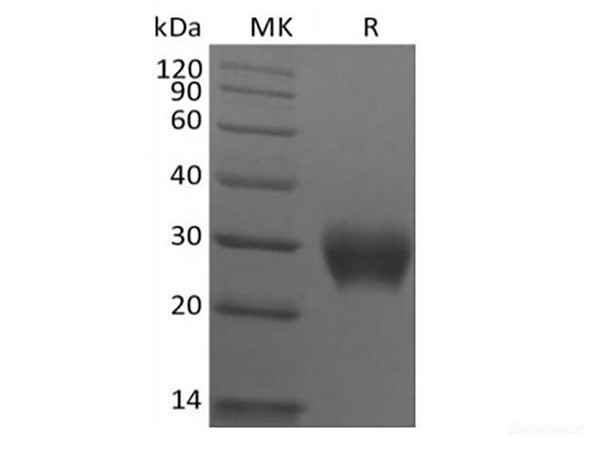 Recombinant Rhesus Macaque Leukocyte-associated Immunoglobulin-like Receptor 1/LAIR1/CD305 (C-6His) (RPES6779)