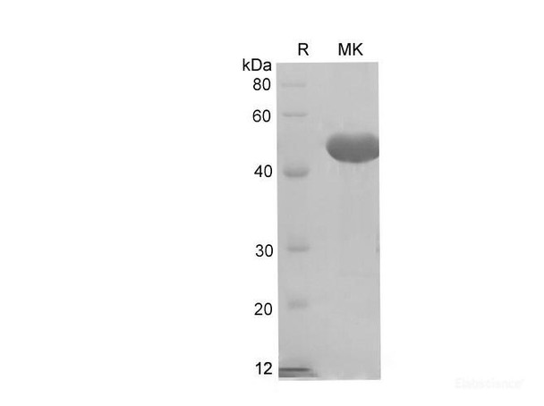 Rat Ceacam1/BGP-1 Recombinant Protein (His Tag) (RPES6832)