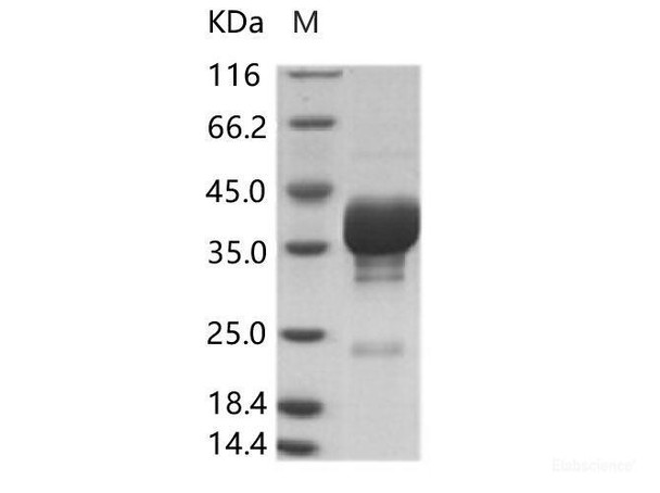 Cox A16 (strain G-10) VP4 Recombinant Protein (Fc Tag) (RPES6885)