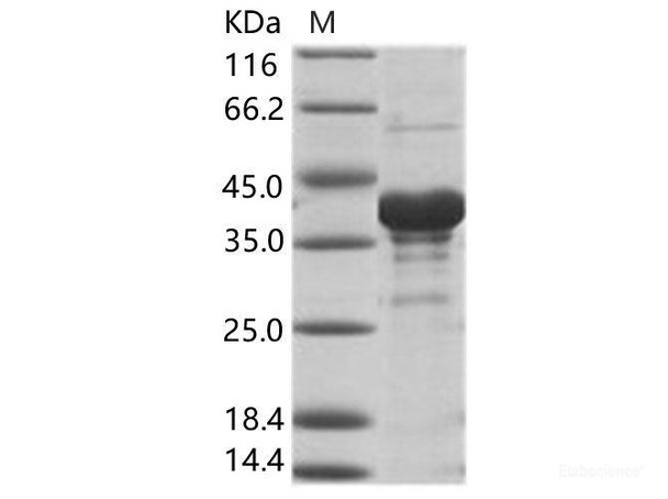 EBOV (subtype Sudan, strain Gulu) VP40 / Matrix Recombinant Protein VP40 Recombinant Protein (His Tag) (RPES6912)