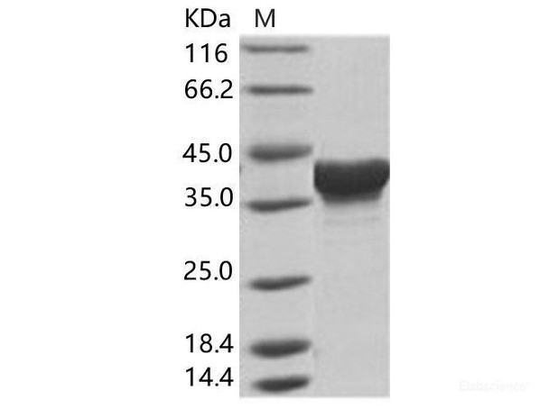 EBOV (subtype Zaire, strain H.sapiens-wt/GIN/2014/Kissidougou-C15) Matrix Recombinant Protein VP40 Recombinant Protein (His Tag) (RPES6922)