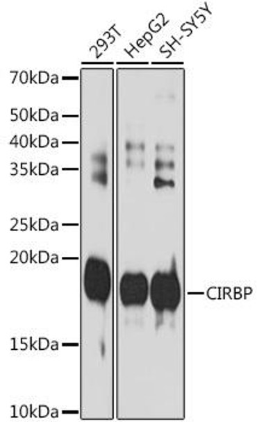 Anti-CIRBP Antibody (CAB19290)