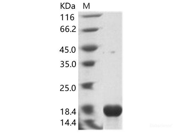 EBOV (Sudan ebolavirus, strain Gulu) NucleoRecombinant Protein / NP Recombinant Protein (His Tag) (RPES6932)