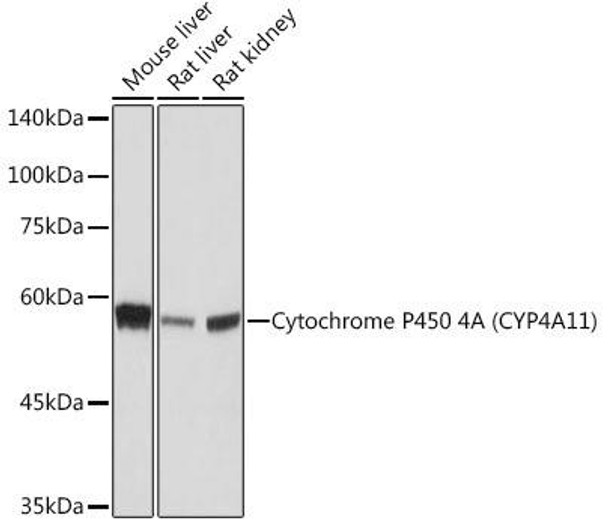 Anti-Cytochrome P450 4A (CYP4A11) Antibody (CAB19662)