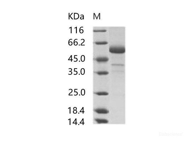 MERS-CoV Spike/RBD Recombinant Protein fragment (RBD, aa 367-606, rFc Tag) (RPES6989)