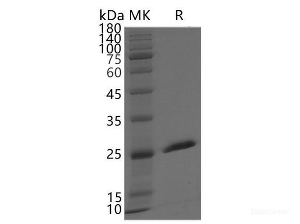 SARS-CoV-2 NSP3 Recombinant Protein (RPES7051)