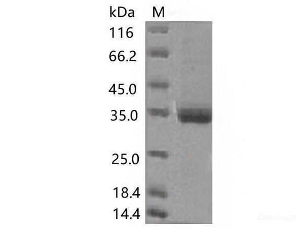 Recombinant SARS-CoV-2 Spike RBD (K417N) (His Tag) (RPES7090)