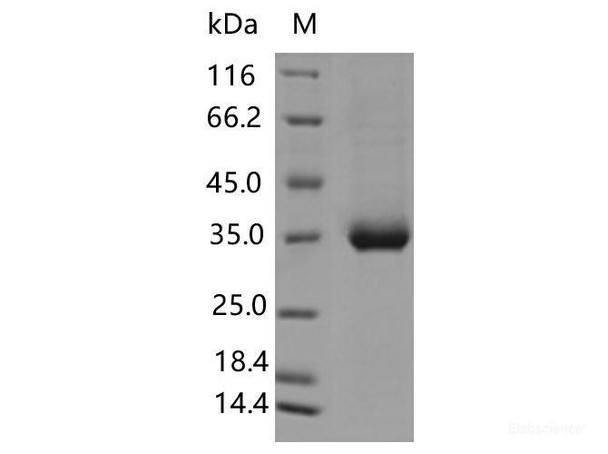 Recombinant SARS-CoV-2 Spike RBD (L455F) (His Tag) (RPES7183)