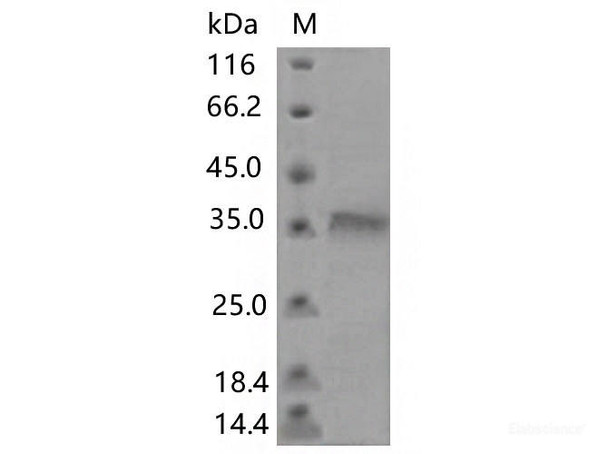 Recombinant SARS-CoV-2 Spike RBD (F456E) (His Tag) (RPES7188)