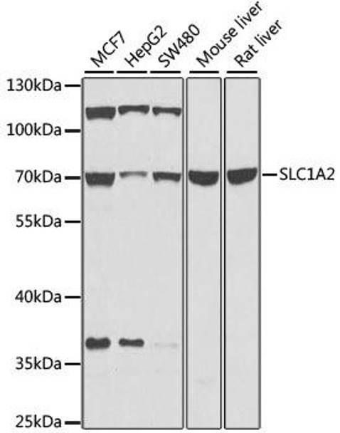 Anti-SLC1A2 Antibody (CAB0910)