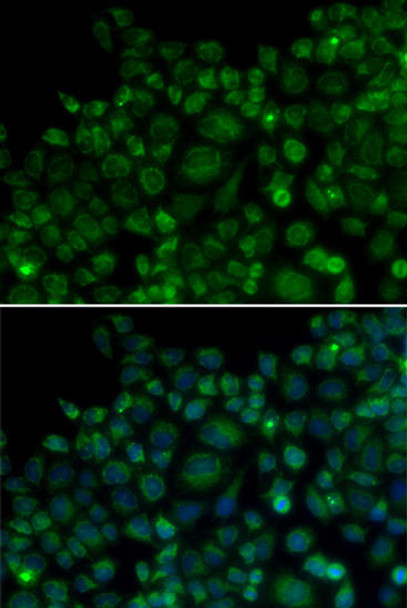 Anti-TLR7 Antibody (CAB0991)