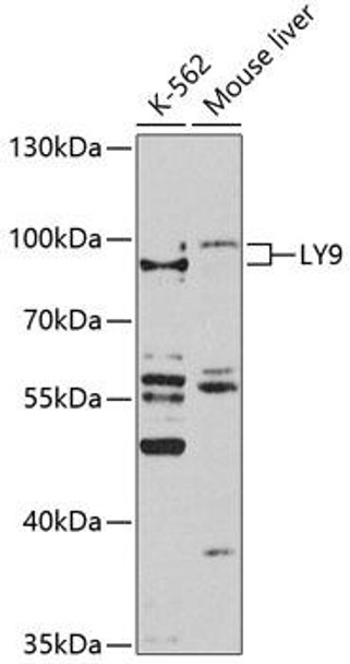 Anti-LY9 Antibody (CAB10032)