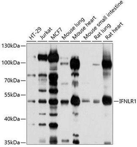 Anti-IFNLR1 Antibody (CAB10082)