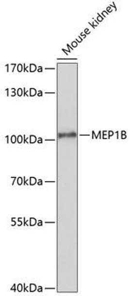 Anti-MEP1B Antibody (CAB10085)