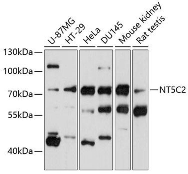 Anti-NT5C2 Antibody (CAB11628)