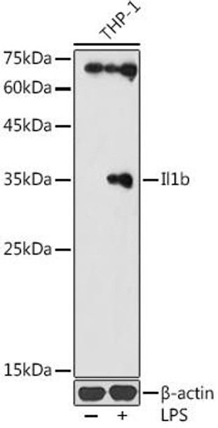 Anti-Il1b Antibody (CAB20527)