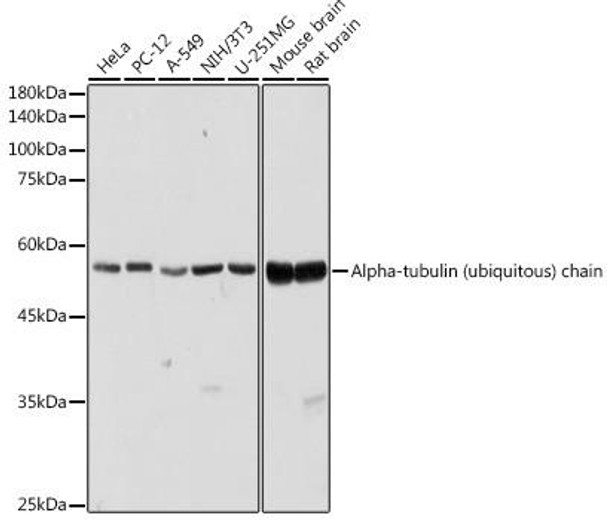 Alpha-tubulin (ubiquitous) chain Rabbit Polyclonal Antibody (CABC025)