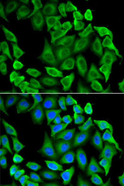 Anti-FAS Antibody (CAB12401)