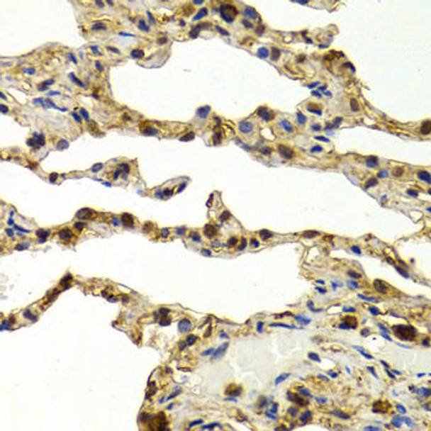 Anti-SULT1A1 Antibody (CAB12514)