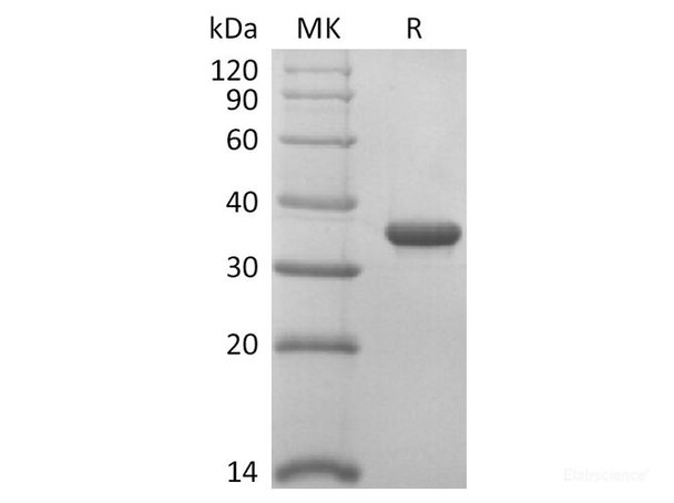 SARS-Cov-2 Papain-Like Protease Recombinant Protein (RPES0008)