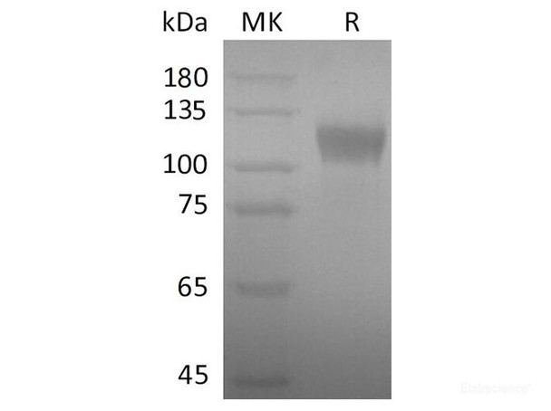 SARS-CoV-2 Spike S1 Recombinant Protein (RPES0017)