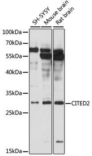 Anti-CITED2 Antibody (CAB12831)