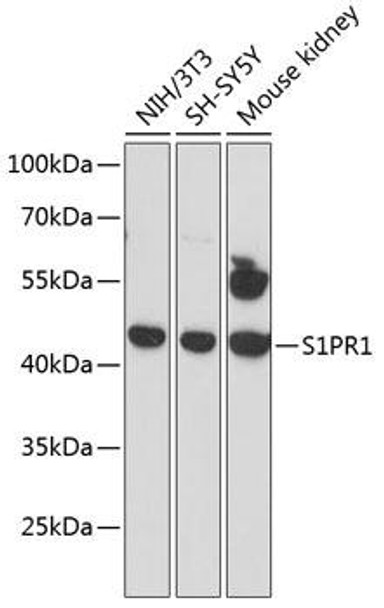 Anti-S1PR1 Antibody (CAB12935)
