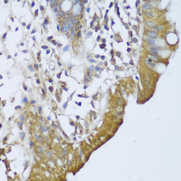 Anti-GCN1L1 Antibody (CAB13075)