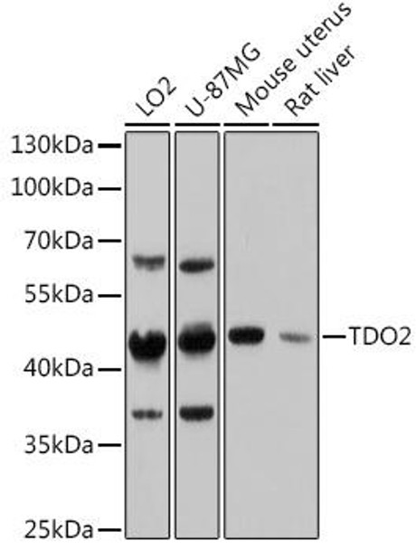 Anti-TDO2 Antibody (CAB13182)