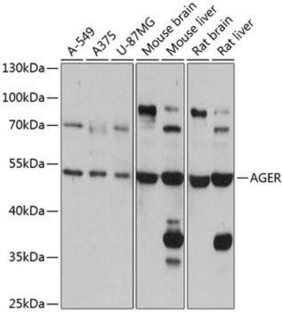 Anti-AGER Antibody (CAB13264)