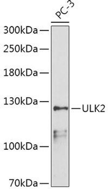 Anti-ULK2 Antibody (CAB15243)