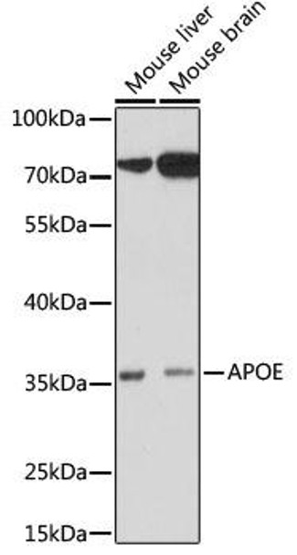 Anti-Apoe Antibody (CAB16344)