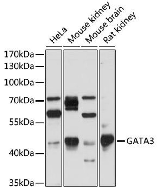 Anti-GATA3 Antibody (CAB1638)