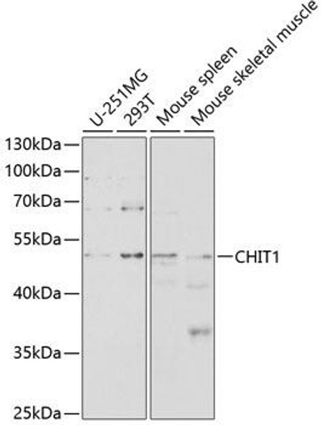 Anti-CHIT1 Antibody (CAB2015)
