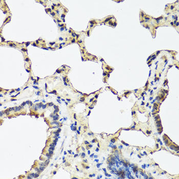 Anti-REG3A Antibody (CAB2101)