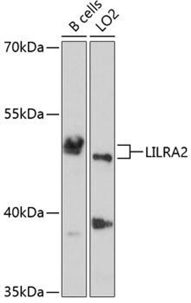 Anti-LILRA2 Antibody (CAB4477)