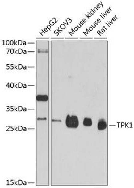 Anti-TPK1 Antibody (CAB4634)