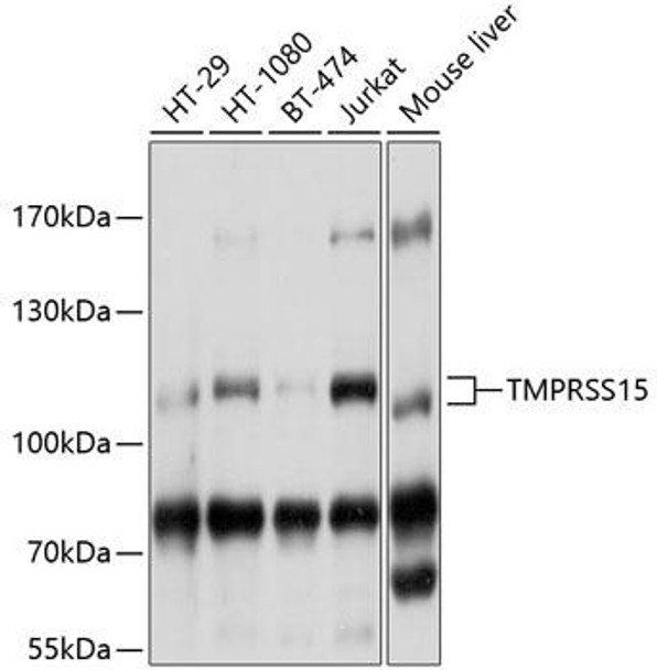 Anti-TMPRSS15 Antibody (CAB10239)