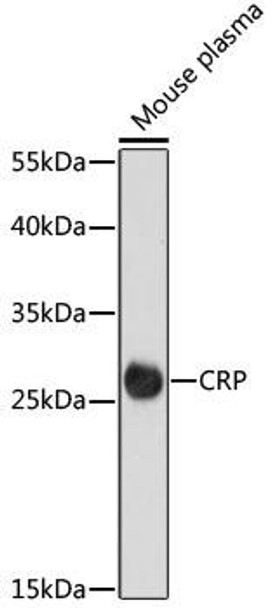 Anti-CRP Antibody (CAB15659)
